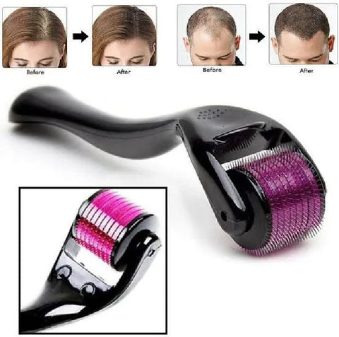 Derma Roller 0.5mm Hair & Skin System with 540 Micro Needle for Hair Growth Skin Care Beauty Tool for Anti-Aging Skin Repair, Anti Wrinkles Stretch, and Acne Scars Removal for Men and Women